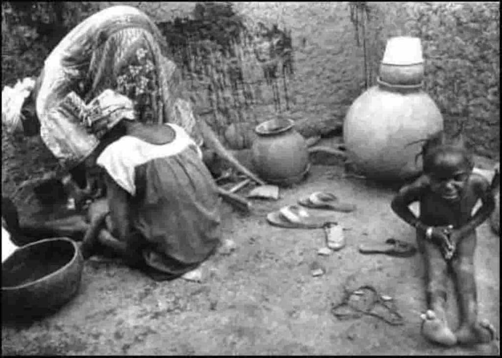 circuncisión Dogón