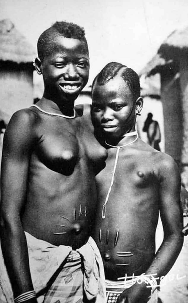 Escarificaciones corporales