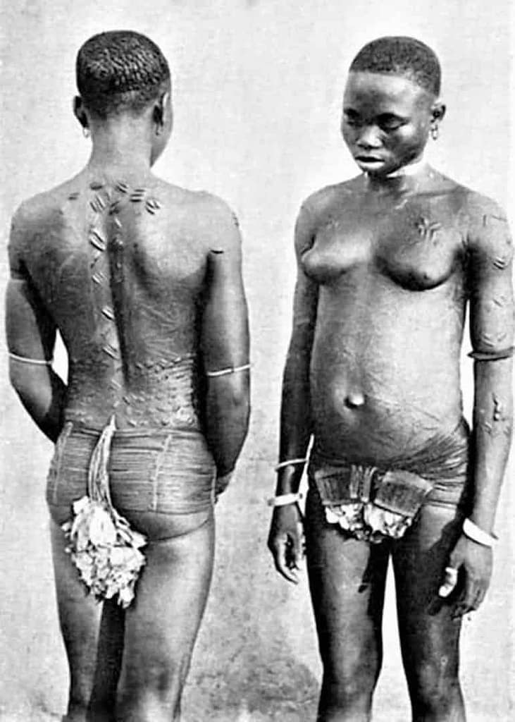 Escarificaciones corporales